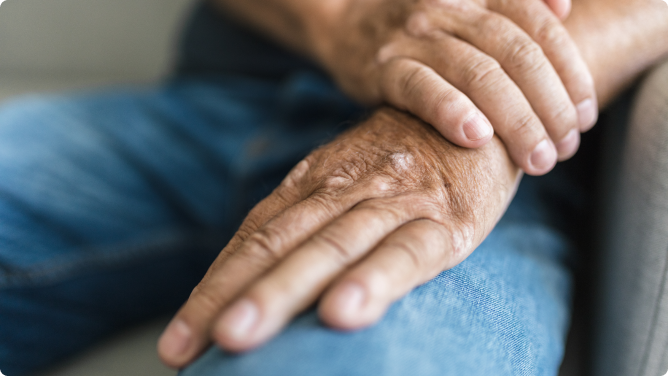 ARTRITIS PSORIÁSICA